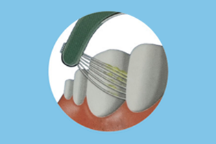 Tecnologia Buletedan